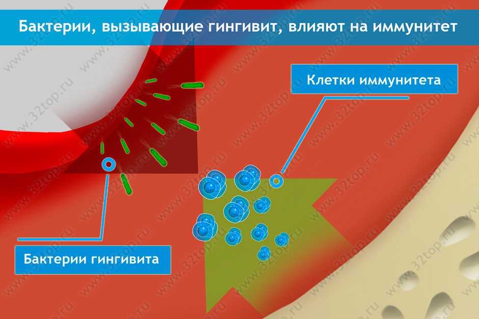 Лептотрихоз