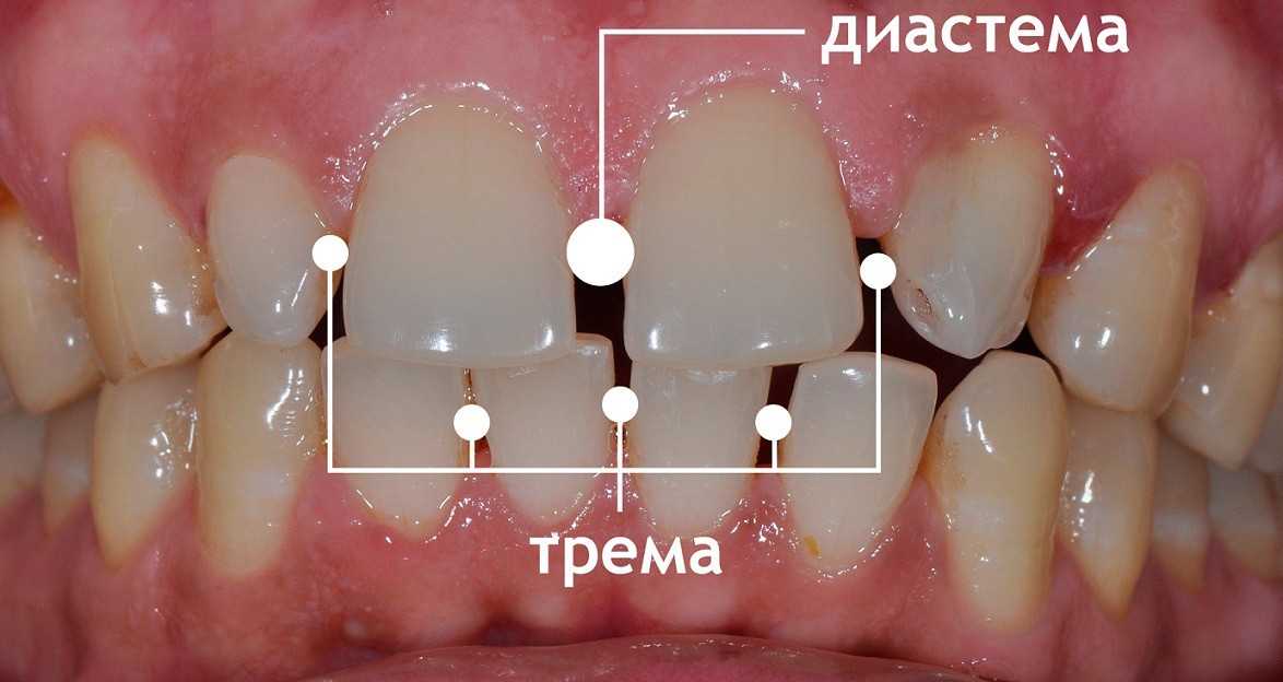 Элайнеры Томск Беломорская детская платная стоматология в томске