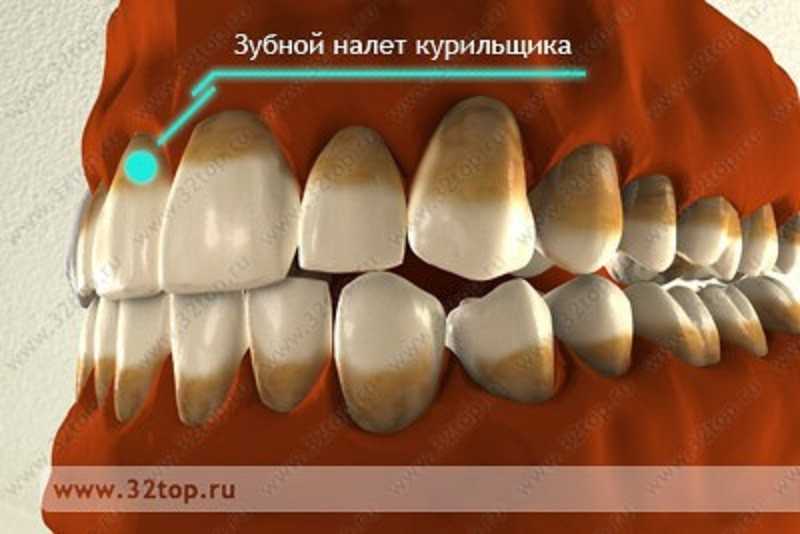 Гигиеническая чистка зубов Томск Курский харизма томск стоматология яковлева
