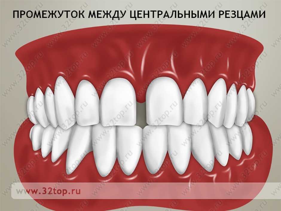 Элайнеры Томск Мостовая Лечение кариеса лазером Томск Дзержинского